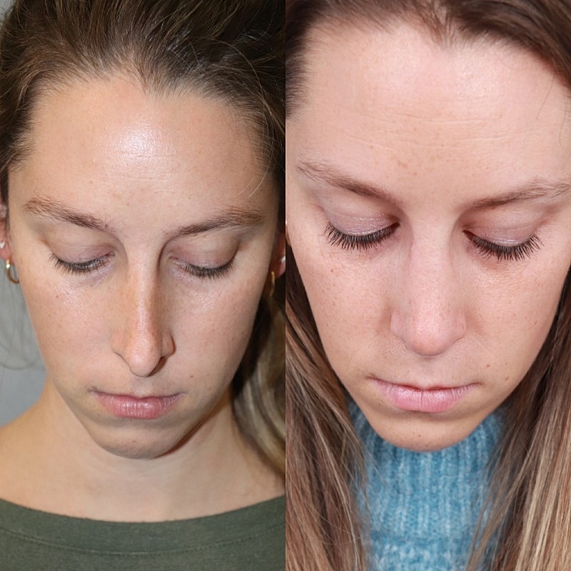 Before & After