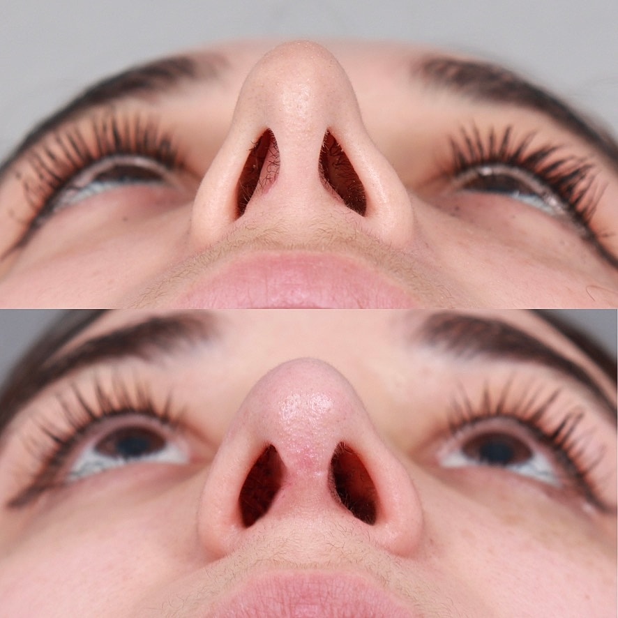 Before & After