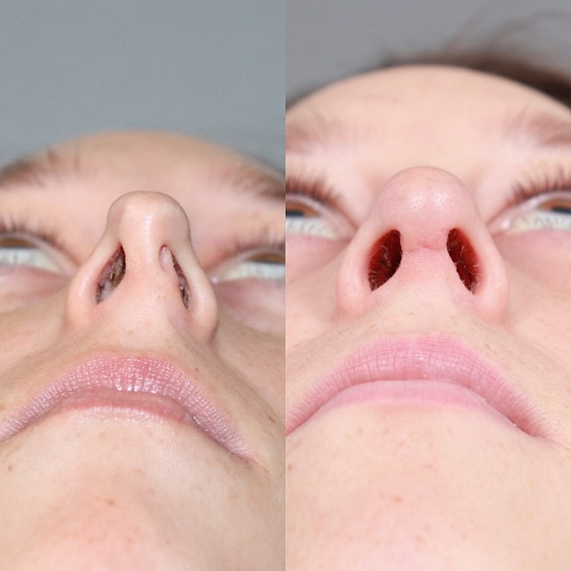 Before & After